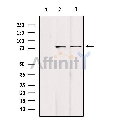KIFC1 Antibody - Western blot analysis of extracts from various samples, using KIFC1 Antibody.
