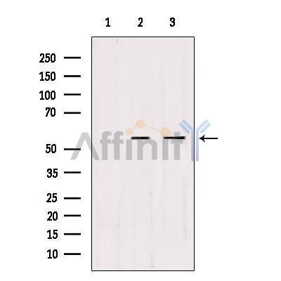 CDKL2 Antibody - Western blot analysis of extracts from various samples, using CDKL2 Antibody.