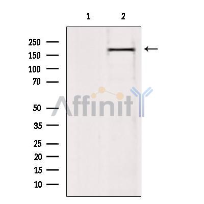BAZ2A Antibody - Western blot analysis of extracts from 293, using BAZ2A Antibody.