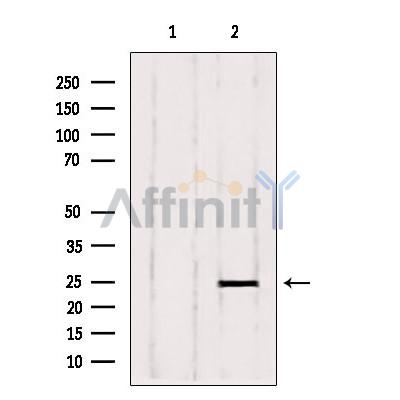 RAB6A Antibody - Western blot analysis of extracts from Hela, using RAB6A Antibody.