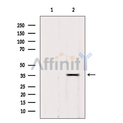 RALY Antibody - Western blot analysis of extracts from 293, using RALY Antibody.