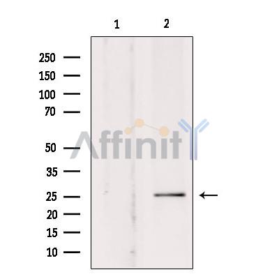 SOD3 Antibody - Western blot analysis of extracts from rat brain, using SOD-3  Antibody.