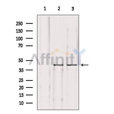 KITH_HHV1S Antibody - Western blot analysis of extracts from various samples, using KITH_HHV1S Antibody.