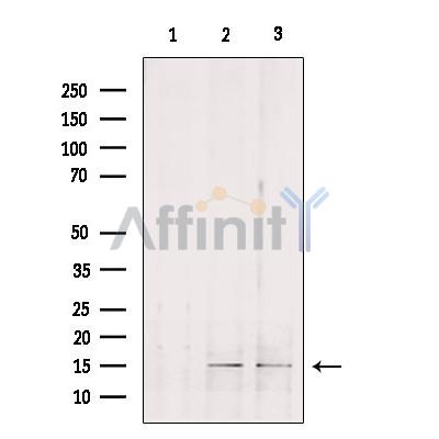 GOLT1B Antibody - Western blot analysis of extracts from various samples, using GOLT1B Antibody.