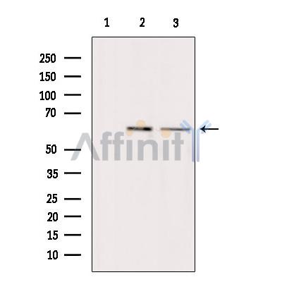 ARSH Antibody - Western blot analysis of extracts from various samples, using ARSH Antibody.