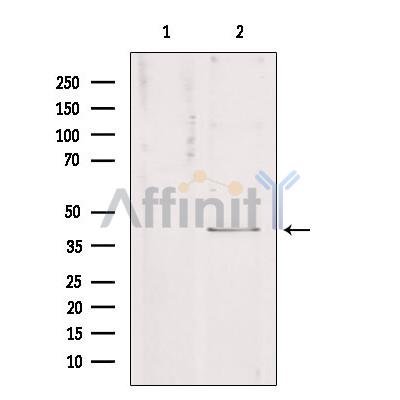 KCNJ10 Antibody - Western blot analysis of extracts from Hela, using KCNJ10 Antibody.