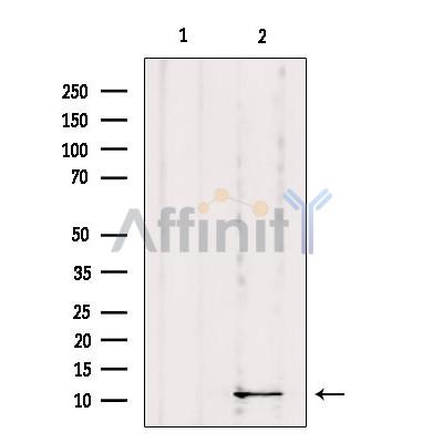 DYNLRB1 Antibody - Western blot analysis of extracts from Mouse Myeloma cell, using DYNLRB1 Antibody.