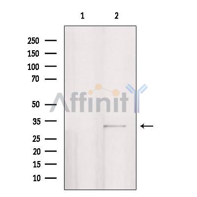 PPP1R3D Antibody - Western blot analysis of extracts from HepG2, using PPP1R3D Antibody.