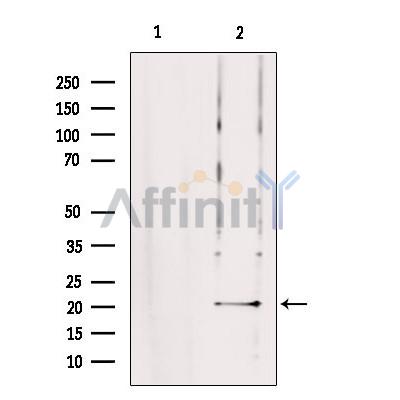 TRAPPC5 Antibody - Western blot analysis of extracts from rat brain, using TRAPPC5 Antibody.