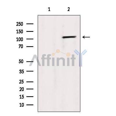 EGFR Antibody - Western blot analysis of extracts from HepG2 cells, using EGFR Antibody.