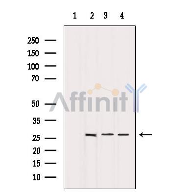 Bcl-2 Antibody - Western blot analysis of extracts from various samples, using BCL-2 Antibody.