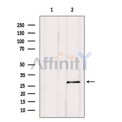 Bcl-2 Antibody - Western blot analysis of extracts from Mouse liver, using BCL-2 Antibody.