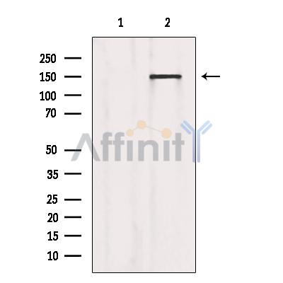 PLCG1 Antibody - Western blot analysis of extracts from Mouse lung, using PLCG1 Antibody.