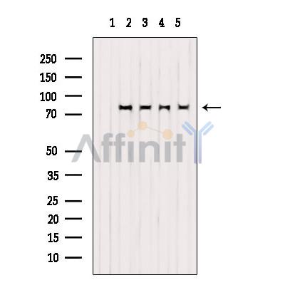 STAT3 Antibody - Western blot analysis of extracts from various samples, using STAT3 Antibody.