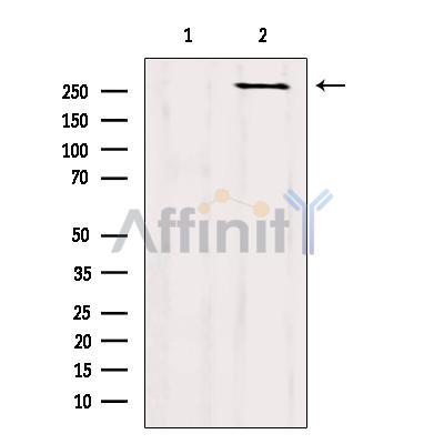 mTOR Antibody - Western blot analysis of extracts from B16F10, using mTOR Antibody.