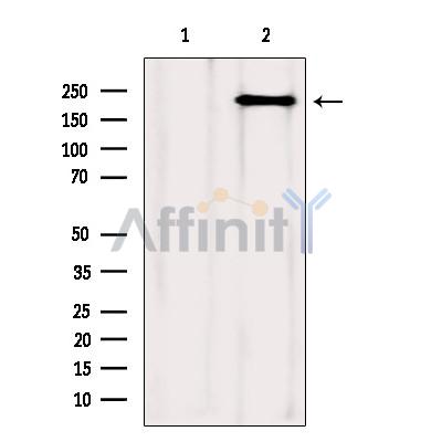 mTOR Antibody - Western blot analysis of extracts from Mouse spleen, using mTOR Antibody.