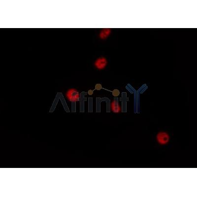 Phospho-p53 (Thr55) Antibody - AF8122 staining MDA-MB-435 by IF/ICC.