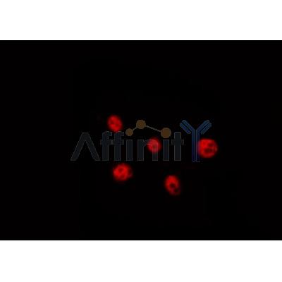 Phospho-p53 (Ser392) Antibody - AF8295 staining MDA-MB-435 by IF/ICC.