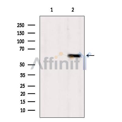 TCTN1 Antibody - Western blot analysis of extracts from Sp2/0, using TCTN1 Antibody.