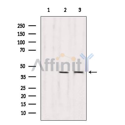 RBM4 Antibody - Western blot analysis of extracts from various samples, using RBM4 Antibody.