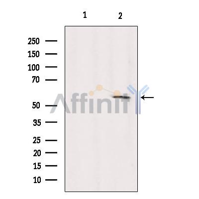 KIF12 Antibody - Western blot analysis of extracts from Sp2/0, using KIF12 Antibody.