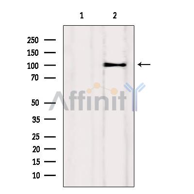 Drebrin Antibody - Western blot analysis of extracts from Myeloma cells, using Drebrin Antibody.