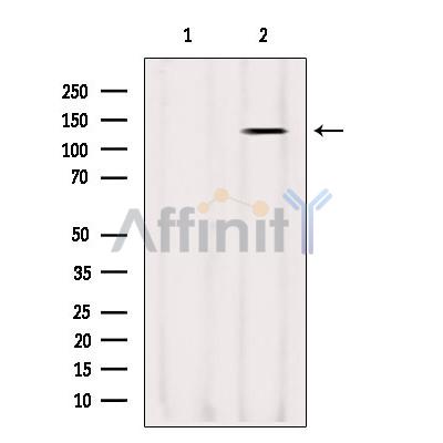 LRPPRC Antibody - Western blot analysis of extracts from Sp2/0, using LRPPRC Antibody.