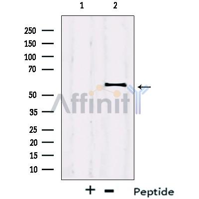 IRF2BP2 Antibody - Western blot analysis on Jurkat cells lysates using IRF2BP2 Antibody.
