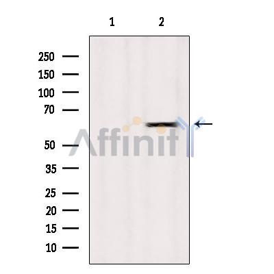 LAT3 Antibody - Western blot analysis of extracts from Mouse spleen, using LAT3 Antibody.