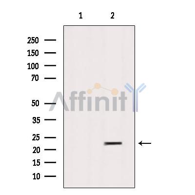 SAR1B Antibody - Western blot analysis of extracts from Sp2/0, using SAR1B Antibody.