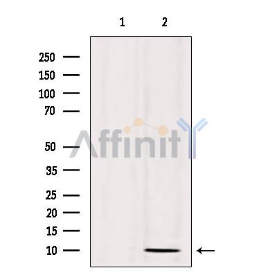 SPINK1 Antibody - Western blot analysis of extracts from 293, using SPINK1 Antibody.