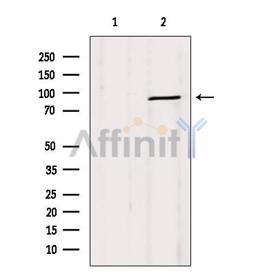 DRP1 Antibody - Western blot analysis of extracts from Mouse lung, using DRP1  Antibody.