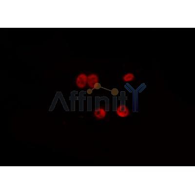 TP53 Antibody - DF7238 staining  MDA-MB-435 cells by IF/ICC.