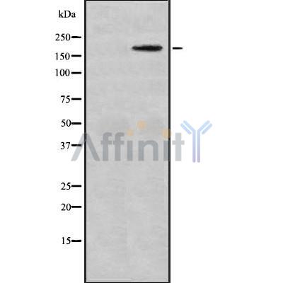 MAST1 Antibody - Western blot analysis of MAST1 using HeLa whole cell lysates.