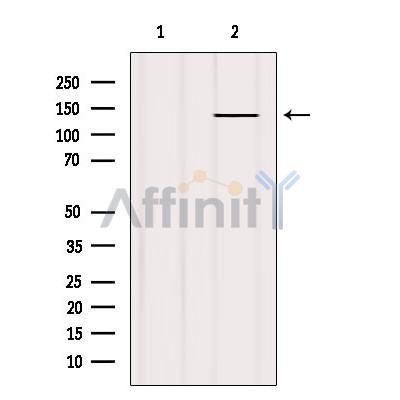 EGFR Antibody - Western blot analysis of extracts from HepG2, using EGFR Antibody.