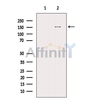 PLCG1 Antibody - Western blot analysis of extracts from VERO, using PLCG1 Antibody.