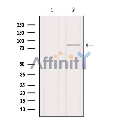 PI3K p85 alpha Antibody - Western blot analysis of extracts from Hela, using PI3-kinase p85-alpha Antibody.