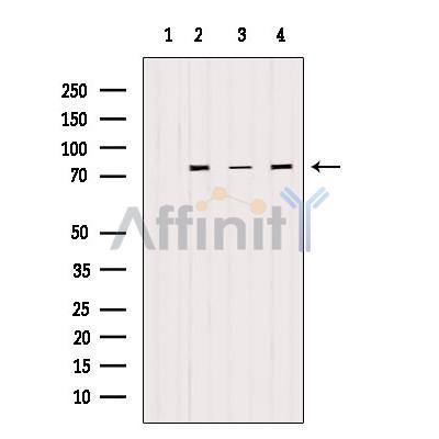 STAT3 Antibody - Western blot analysis of extracts from various samples, using STAT3 Antibody.