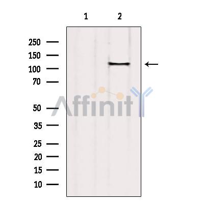 c-PLA2 Antibody - Western blot analysis of extracts from HepG2, using c-PLA2 Antibody.