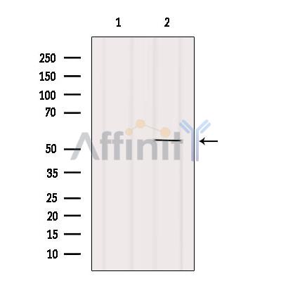 XIAP Antibody - Western blot analysis of extracts from B16F10, using XIAP Antibody.