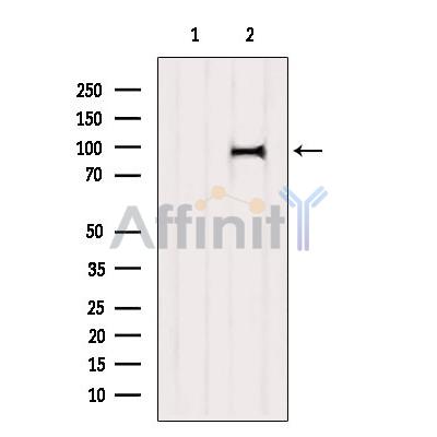 ANKRD20 Antibody - Western blot analysis of extracts from Hela, using ANKRD20 Antibody.
