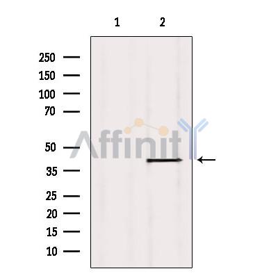 IL20L2 Antibody - Western blot analysis of extracts from 293, using IL20L2 Antibody.