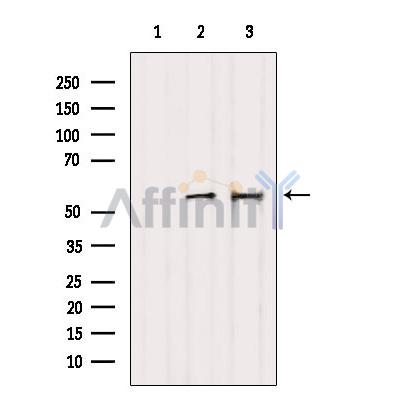 KRT81/86 Antibody - Western blot analysis of extracts from various samples, using KRT81/86 Antibody.
