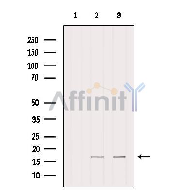 IFT20 Antibody - Western blot analysis of extracts from various samples, using IFT20 Antibody.