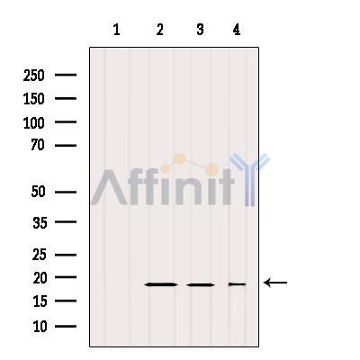 IFT20 Antibody - Western blot analysis of extracts from various samples, using IFT20 Antibody.