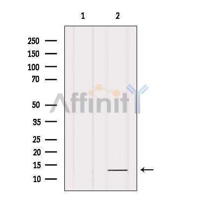FXYD1/PLM Antibody - Western blot analysis of extracts from Mouse lung, using Phospholemman Antibody.