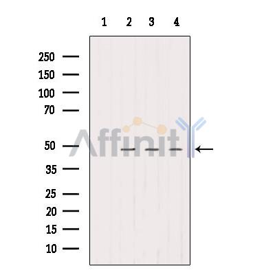 SMCR7/MID49 Antibody - Western blot analysis of extracts from various samples, using SMCR7/MID49 Antibody.