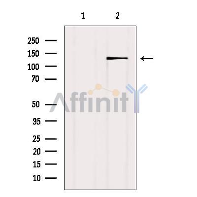TET2 Antibody - Western blot analysis of extracts from Mouse brain, using TET2 Antibody.
