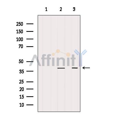 STBD1 Antibody - Western blot analysis of extracts from various samples, using STBD1 Antibody.