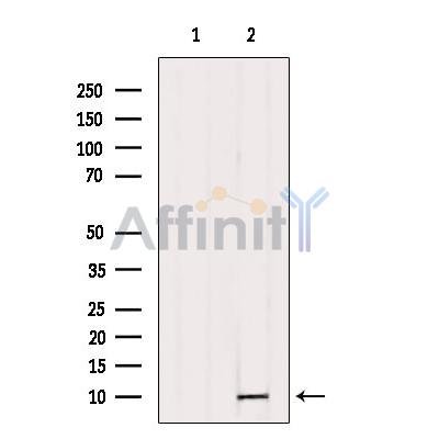 TNP1 Antibody - Western blot analysis of extracts from B16F10, using TNP1 Antibody.